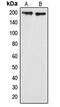 Glucocorticoid receptor DNA-binding factor 1 antibody, MBS821762, MyBioSource, Western Blot image 