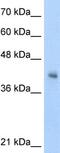 V-Set And Immunoglobulin Domain Containing 4 antibody, ab56037, Abcam, Western Blot image 
