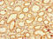 Lactamase Beta 2 antibody, LS-C377691, Lifespan Biosciences, Immunohistochemistry paraffin image 