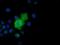 Adenylate Kinase 5 antibody, NBP2-02978, Novus Biologicals, Immunocytochemistry image 