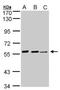 Arylsulfatase E antibody, NBP1-32439, Novus Biologicals, Western Blot image 
