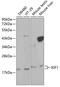 Insulin Like Growth Factor 1 antibody, 13-137, ProSci, Western Blot image 