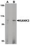 KN Motif And Ankyrin Repeat Domains 3 antibody, PA5-34540, Invitrogen Antibodies, Western Blot image 