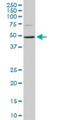 Ankyrin Repeat And SOCS Box Containing 10 antibody, H00136371-M02, Novus Biologicals, Western Blot image 