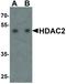 Histone Deacetylase 2 antibody, LS-C336189, Lifespan Biosciences, Western Blot image 