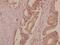 DNA Ligase 1 antibody, A02380, Boster Biological Technology, Immunohistochemistry paraffin image 