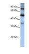 Inositol Polyphosphate-5-Phosphatase B antibody, NBP1-54719, Novus Biologicals, Western Blot image 