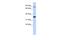 Ring Finger Protein 207 antibody, A11490, Boster Biological Technology, Western Blot image 