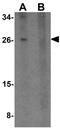 Transmembrane Protein 88 antibody, GTX32020, GeneTex, Western Blot image 