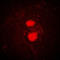 Fyn Related Src Family Tyrosine Kinase antibody, LS-C352208, Lifespan Biosciences, Immunofluorescence image 