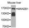 Lysosomal alpha-mannosidase antibody, STJ111978, St John