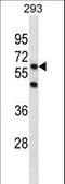 PiggyBac Transposable Element Derived 3 antibody, LS-C158045, Lifespan Biosciences, Western Blot image 