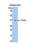 Coagulation Factor II, Thrombin antibody, LS-C304764, Lifespan Biosciences, Western Blot image 