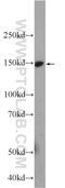 SET Binding Protein 1 antibody, 16841-1-AP, Proteintech Group, Western Blot image 