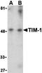 Hepatitis A Virus Cellular Receptor 1 antibody, orb74723, Biorbyt, Western Blot image 