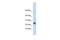 Granulysin antibody, PA5-42157, Invitrogen Antibodies, Western Blot image 