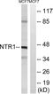 Neurotensin Receptor 1 antibody, GTX16313, GeneTex, Western Blot image 