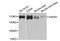 Scaffold Attachment Factor B2 antibody, A4330, ABclonal Technology, Western Blot image 