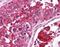 Mechanistic Target Of Rapamycin Kinase antibody, GTX48628, GeneTex, Immunohistochemistry paraffin image 