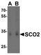 SCO Cytochrome C Oxidase Assembly Protein 2 antibody, A02749, Boster Biological Technology, Western Blot image 