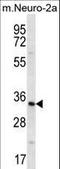 Peroxisomal Biogenesis Factor 14 antibody, LS-C163528, Lifespan Biosciences, Western Blot image 