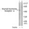 Thyroid Hormone Receptor Alpha antibody, GTX17590, GeneTex, Western Blot image 