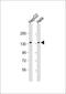 RNA Binding Motif Protein 6 antibody, M08776, Boster Biological Technology, Western Blot image 