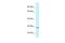 Transmembrane Protein 106B antibody, PA5-69474, Invitrogen Antibodies, Western Blot image 
