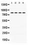 Polymeric Immunoglobulin Receptor antibody, PB9776, Boster Biological Technology, Western Blot image 