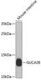 Guanylate Cyclase Activator 2B antibody, GTX66518, GeneTex, Western Blot image 