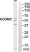 Gsdmc1 antibody, TA315616, Origene, Western Blot image 