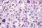 Mitogen-Activated Protein Kinase Kinase Kinase 8 antibody, LS-C175974, Lifespan Biosciences, Immunohistochemistry frozen image 