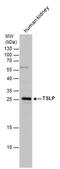 Thymic Stromal Lymphopoietin antibody, PA5-78610, Invitrogen Antibodies, Western Blot image 