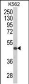 Killer Cell Immunoglobulin Like Receptor, Three Ig Domains And Short Cytoplasmic Tail 1 antibody, PA5-49621, Invitrogen Antibodies, Western Blot image 