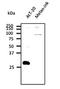 RAB27B, Member RAS Oncogene Family antibody, orb153354, Biorbyt, Western Blot image 