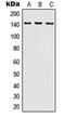 Inositol Polyphosphate-5-Phosphatase D antibody, LS-C352374, Lifespan Biosciences, Western Blot image 