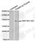 Mitogen-Activated Protein Kinase Kinase Kinase 5 antibody, AP0394, ABclonal Technology, Western Blot image 