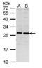 Proteasome 26S Subunit, Non-ATPase 10 antibody, GTX113813, GeneTex, Western Blot image 