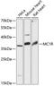 Melanocortin 1 Receptor antibody, 14-821, ProSci, Western Blot image 