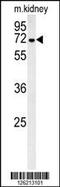 Glucosamine (UDP-N-Acetyl)-2-Epimerase/N-Acetylmannosamine Kinase antibody, 61-879, ProSci, Western Blot image 