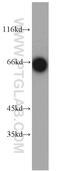 Translocase Of Outer Mitochondrial Membrane 70 antibody, 14528-1-AP, Proteintech Group, Western Blot image 