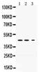 Serpin Family I Member 1 antibody, PA5-79981, Invitrogen Antibodies, Western Blot image 