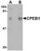 Cytoplasmic polyadenylation element-binding protein 1 antibody, MBS150196, MyBioSource, Western Blot image 