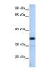 Potassium Channel Tetramerization Domain Containing 4 antibody, NBP1-80106, Novus Biologicals, Western Blot image 