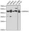 Alpha-1-antitrypsin antibody, GTX54713, GeneTex, Western Blot image 