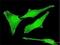 SET Nuclear Proto-Oncogene antibody, H00006418-M01, Novus Biologicals, Immunofluorescence image 