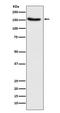 TSC Complex Subunit 1 antibody, M00365-1, Boster Biological Technology, Western Blot image 