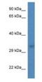 TRNA-Histidine Guanylyltransferase 1 Like antibody, NBP1-74219, Novus Biologicals, Western Blot image 