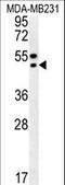 Translocation Associated Membrane Protein 2 antibody, LS-C160163, Lifespan Biosciences, Western Blot image 