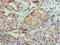 Autoimmune Regulator antibody, LS-C677097, Lifespan Biosciences, Immunohistochemistry paraffin image 